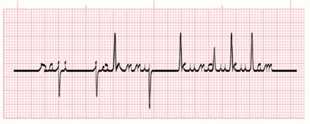 Healthcare font - ECG saji